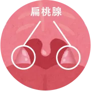 扁桃腺・アデノイド肥大