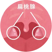扁桃腺・アデノイド肥大