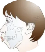 骨格の問題